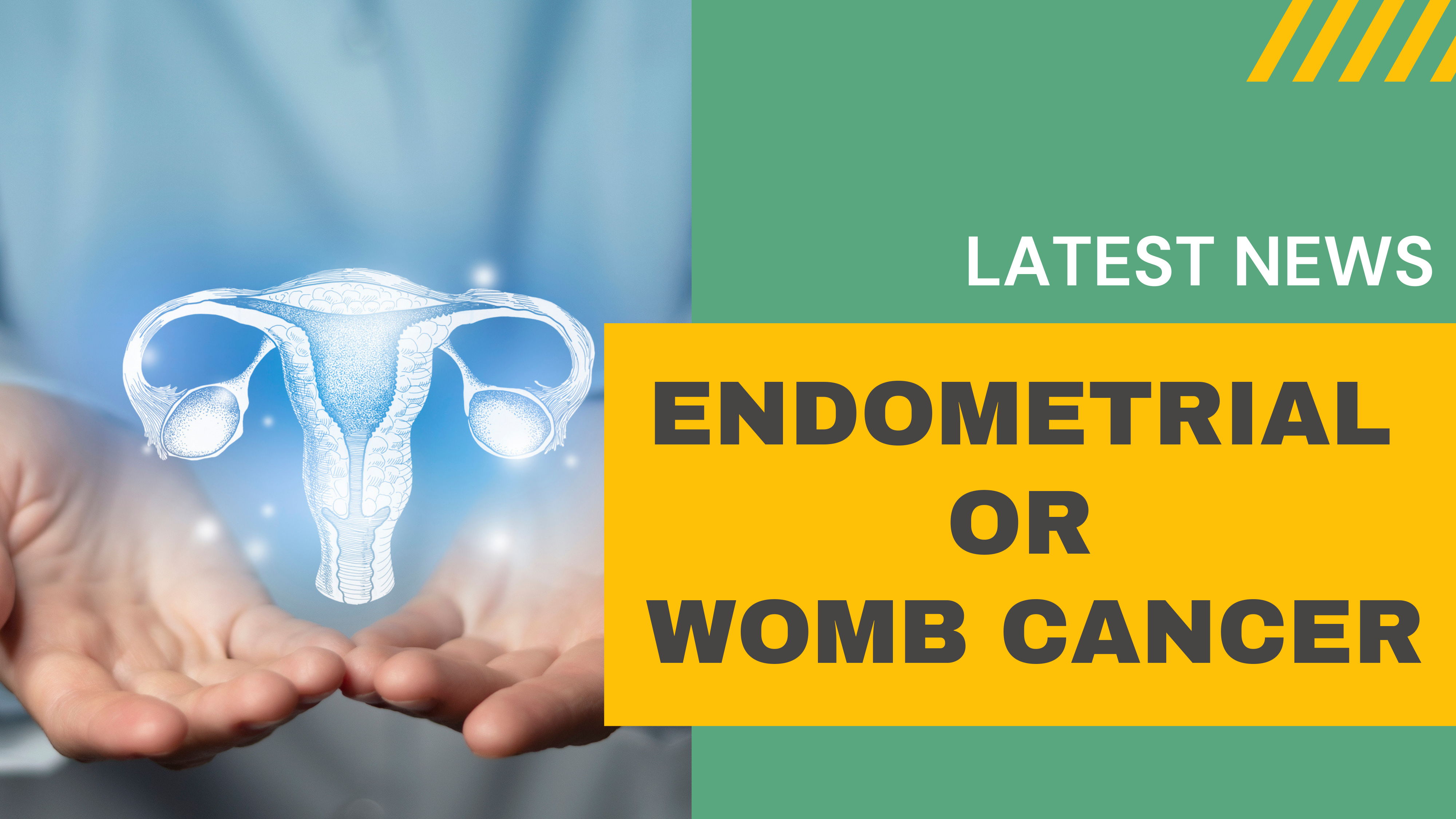 Cancer of the Womb (Endometrial Cancer)
