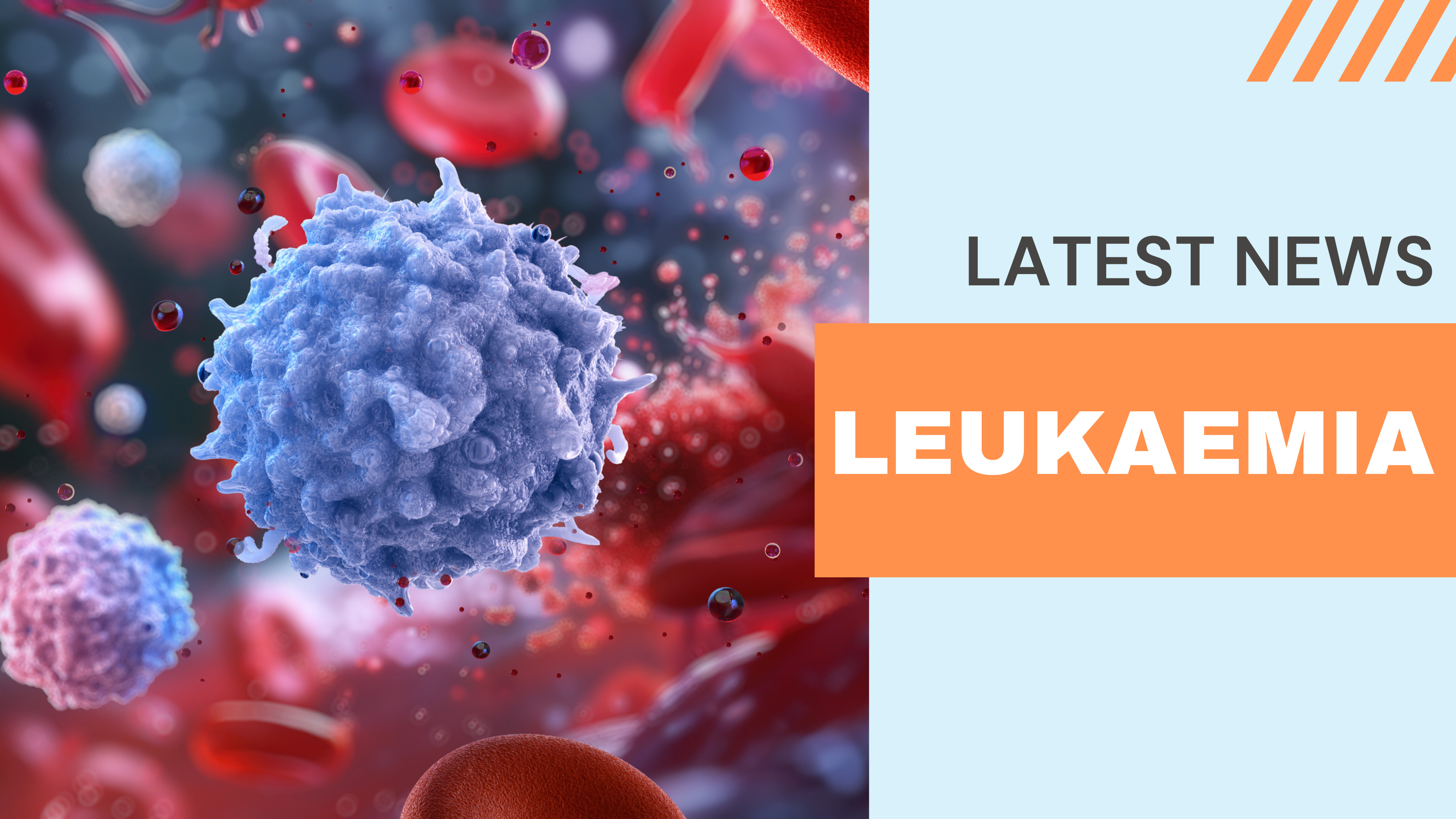 Leukaemia