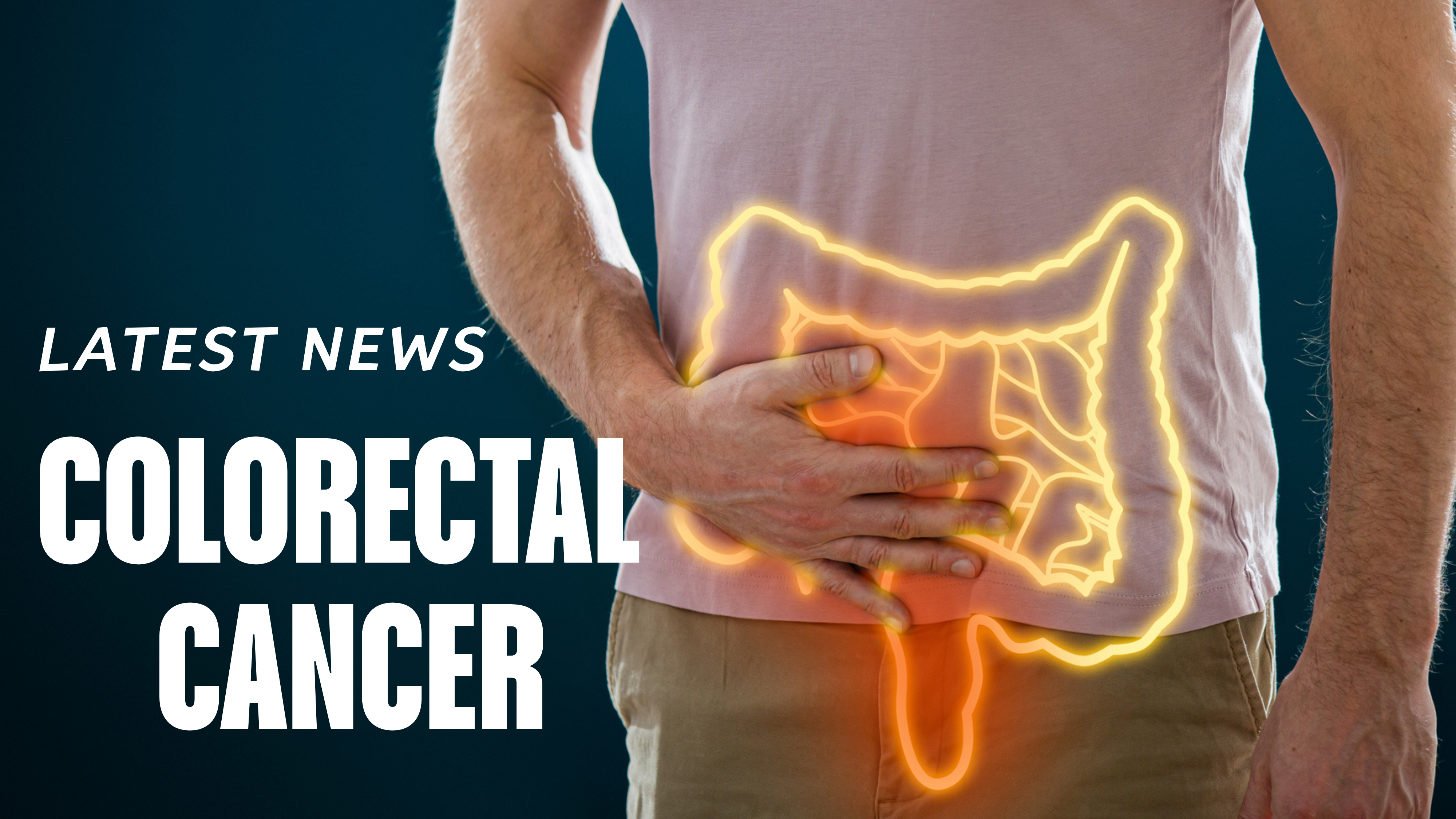 Colorectal cancer