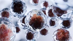 Why Apoptosis is essential to your health