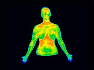 Thermography