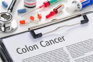Colorectal Cancer - Latest News, Latest Research | CANCERactive