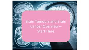 An Overview of Brain Tumours and brain cancer - symptoms, causes and treatment alternatives