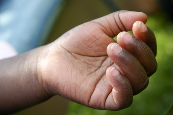 Topical polyphenols mitigate distressing chemotherapy related nail damage - The UK PolyBalm Study