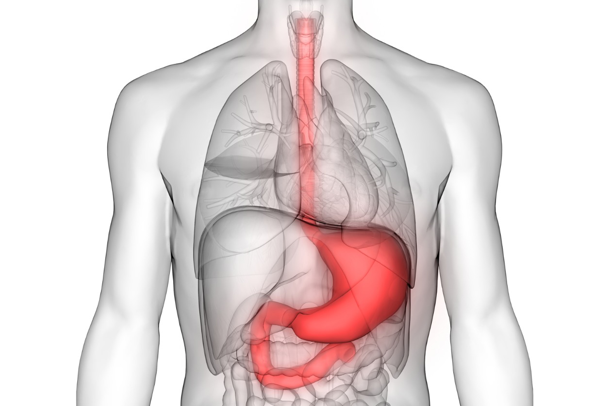 An Overview of Stomach or gastric Cancer - symptoms, treatments and therapies