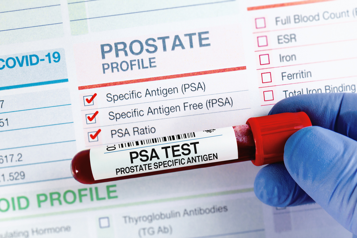 PSA Tests Under The Cosh Again