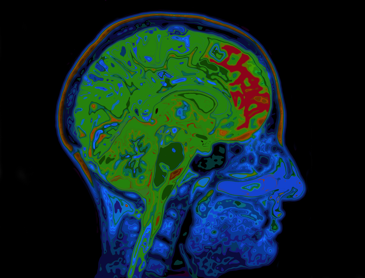 The Latest Treatments for brain tumours